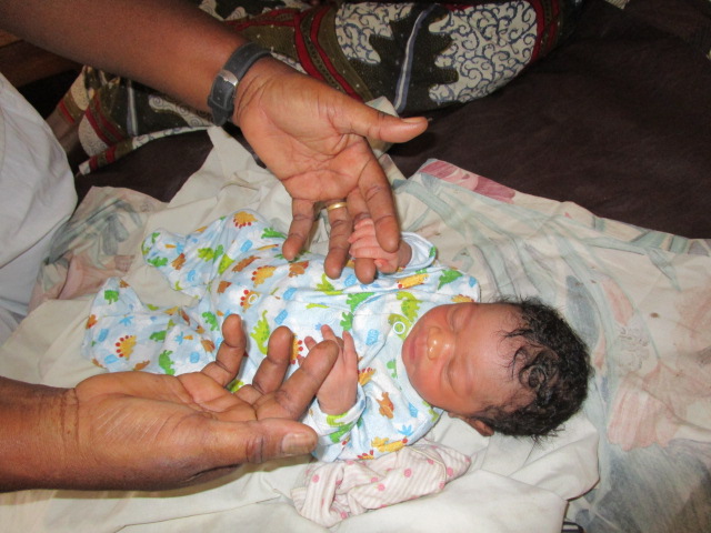 Checking baby's reflexes at birth.