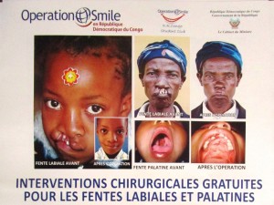 Participation in Operation Smile